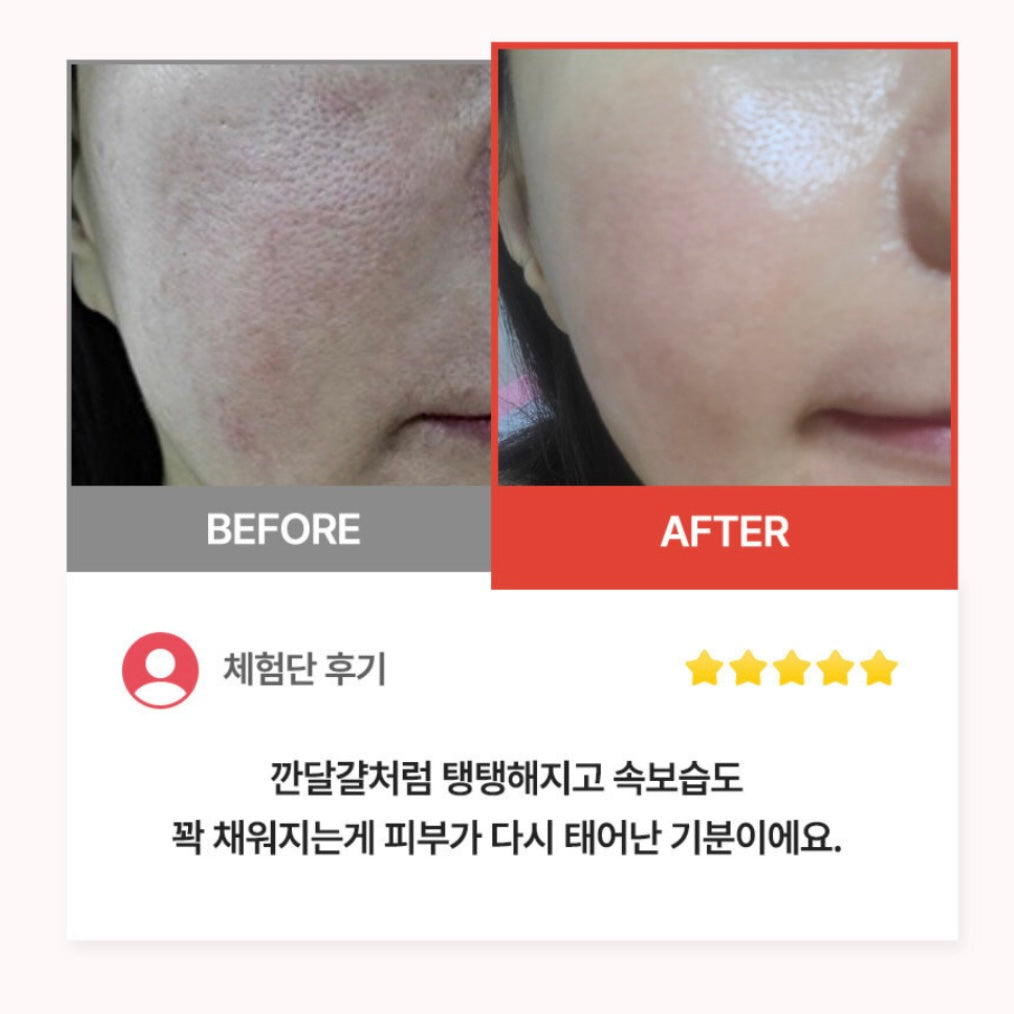Benestem Human CBCM Cream 敏感肌必備⭐️高保濕修復霜  (50ml)