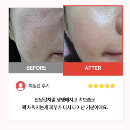 Benestem Human CBCM Cream 敏感肌必備⭐️高保濕修復霜  (50ml)