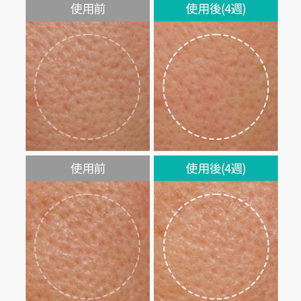 Dr.Melaxin BP還原零孔煥膚面膜 (一盒5片)