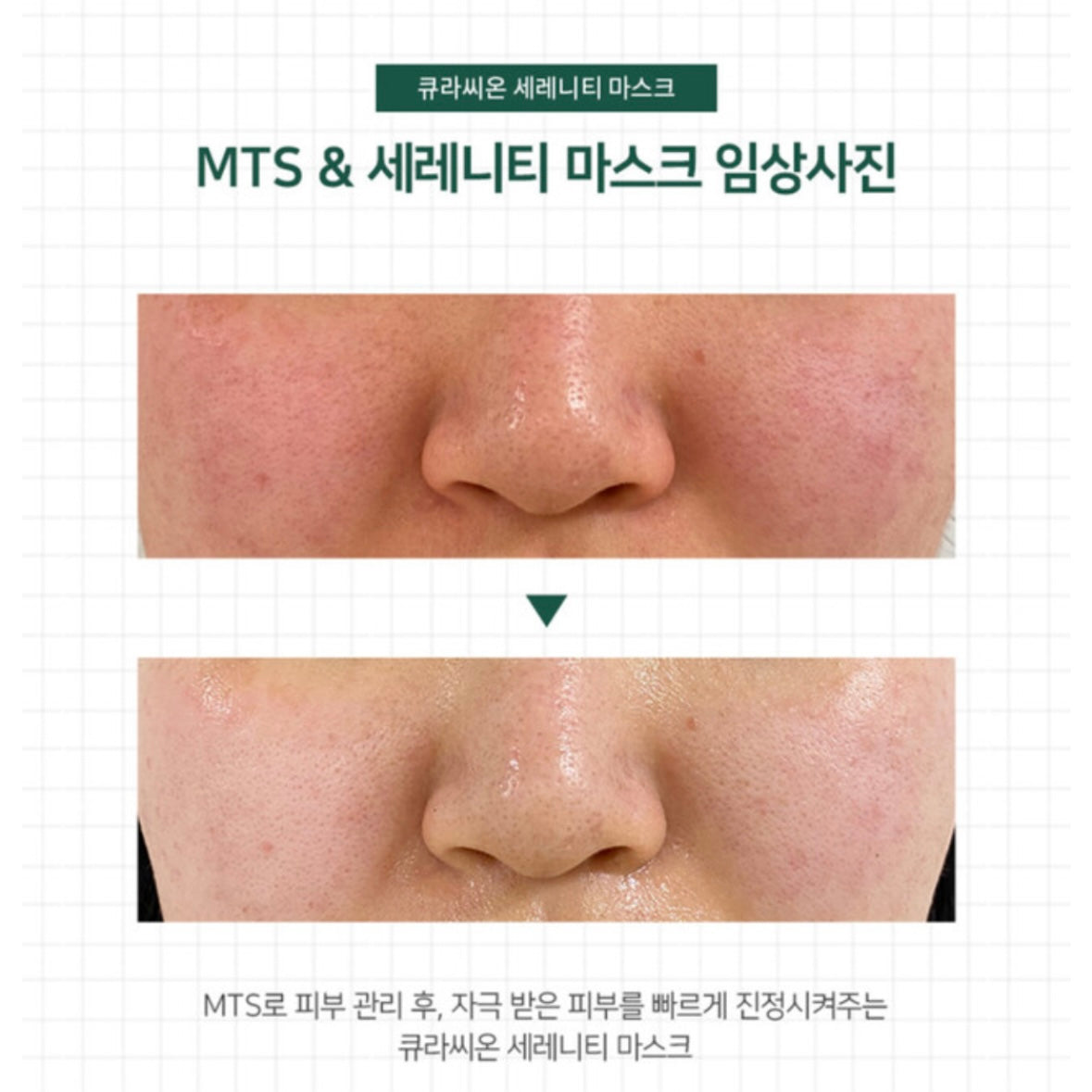 Curación Lacto Care Serenity Mask (一盒5片)
