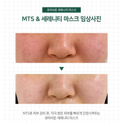 Curación Lacto Care Serenity Mask (一盒5片)