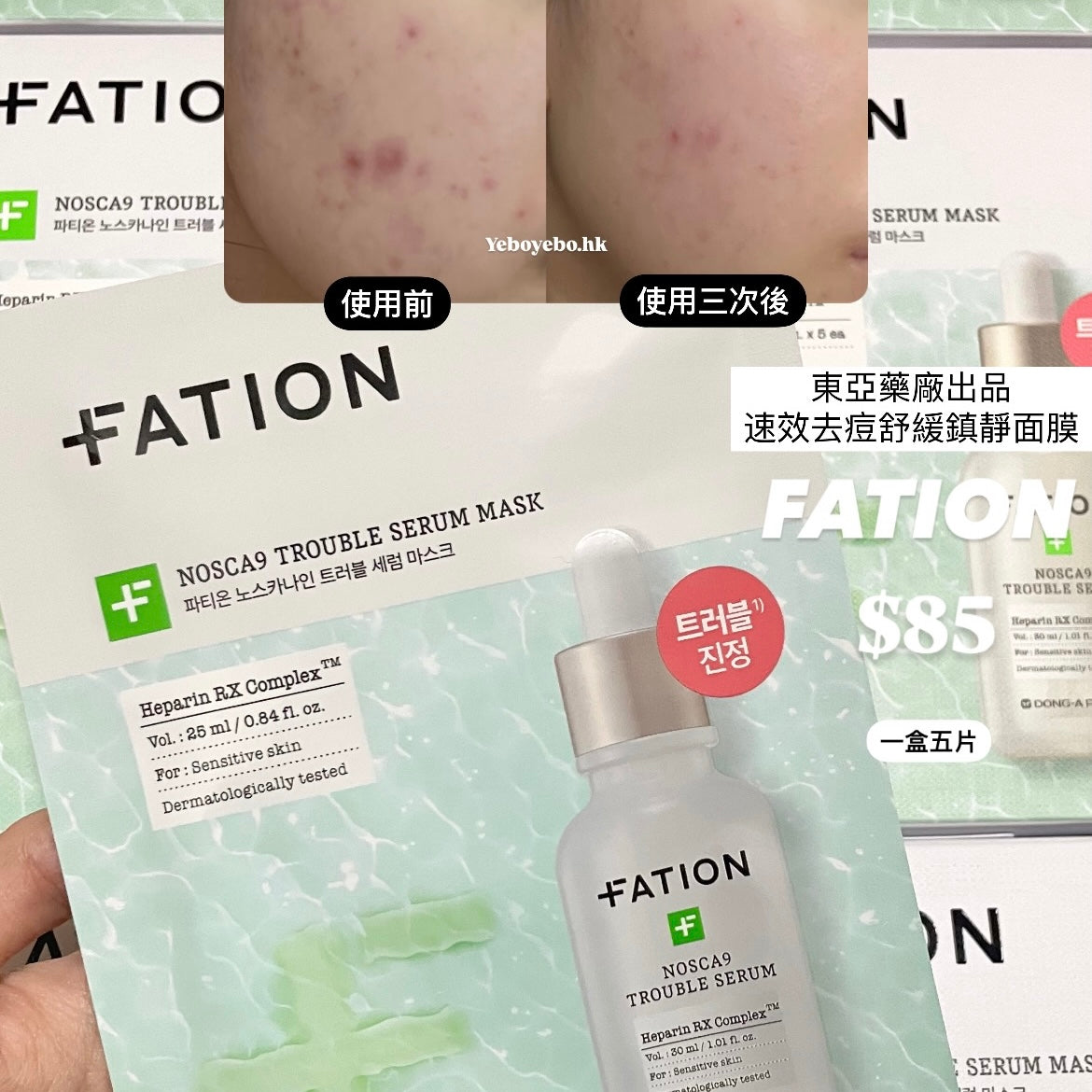 Fation東亞藥廠出品 速效去痘舒緩鎮靜面膜 (一盒5片)￼