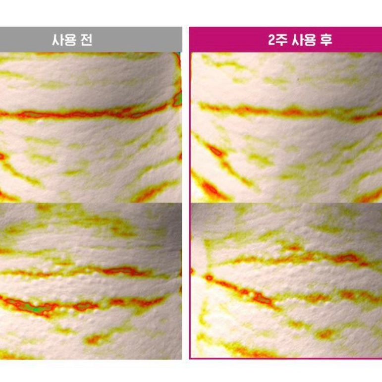 CKD [1+1]膠原蛋白頸紋碌碌消除霜 (50ml+補充裝)