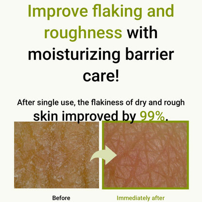 韓國皮膚科醫生推薦️!! ZEROID Intensive Cream 80ml (+50ml)
