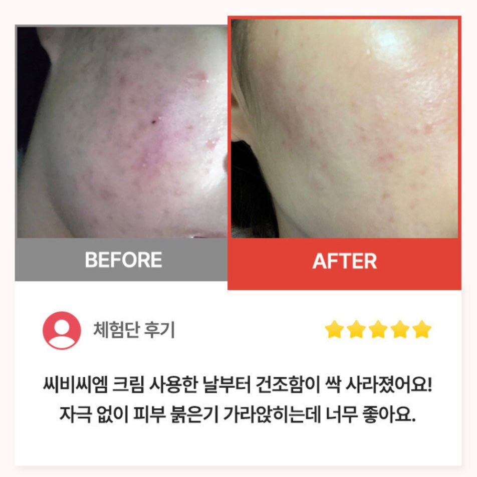 Benestem Human CBCM Cream 敏感肌必備⭐️高保濕修復霜  (50ml)