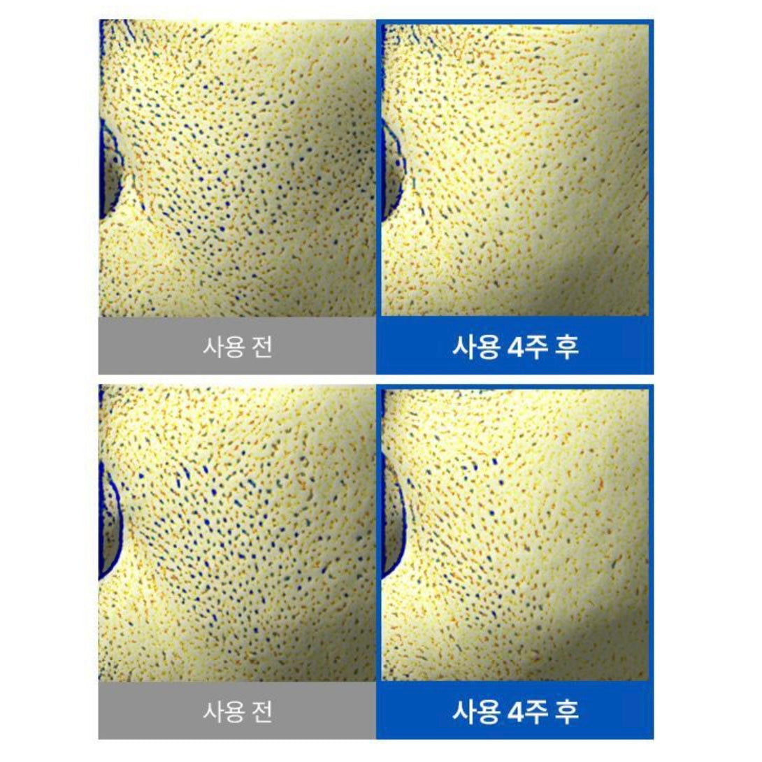 New!! Anua 8重玻尿酸兒茶素保濕抗氧化 鎮靜舒緩棉片 (110片+refill 110片)