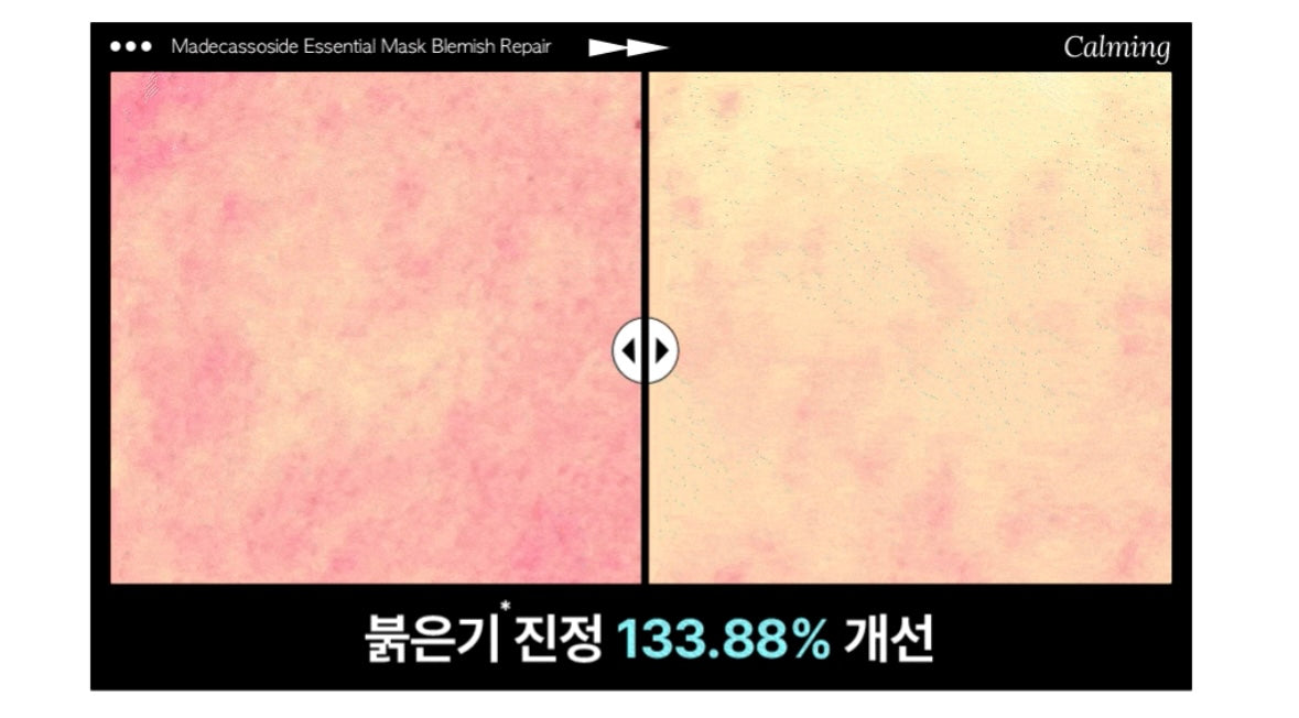 Mediheal 羥基積雪草苷精華修復面膜