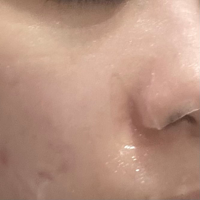 Eucerin 4重修護配方舒敏特效修護面膜