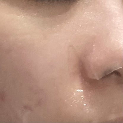 Eucerin 4重修護配方舒敏特效修護面膜