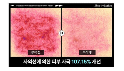 Mediheal 羥基積雪草苷精華修復面膜