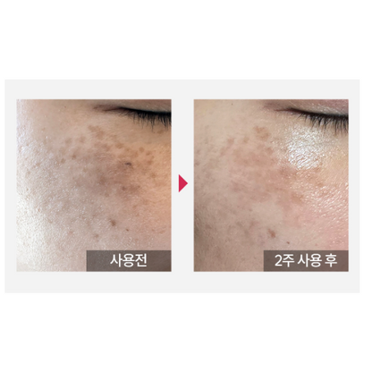 韓國知名皮膚科診所合作開發! Kopher Curepair Mela Cream (35ml)