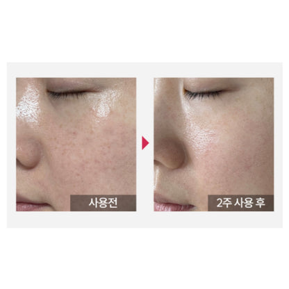 韓國知名皮膚科診所合作開發! Kopher Curepair Mela Cream (35ml)